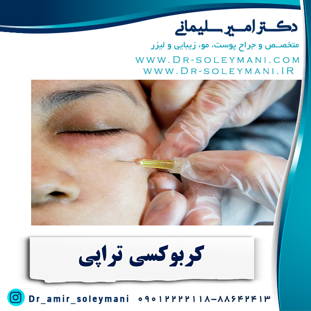 هزینه کربوکسی تراپی در تهران