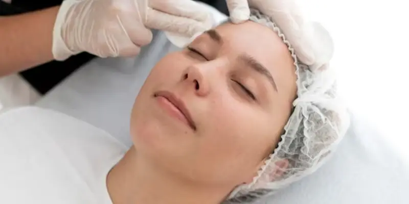 لیزر درمانی برای درمان لک صورت