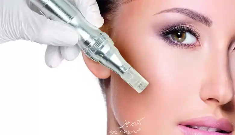 مراقبت های بعد از میکرونیدلینگ