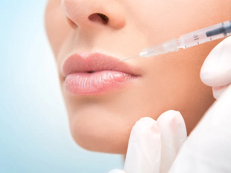 تزریق ژل لب طبیعی