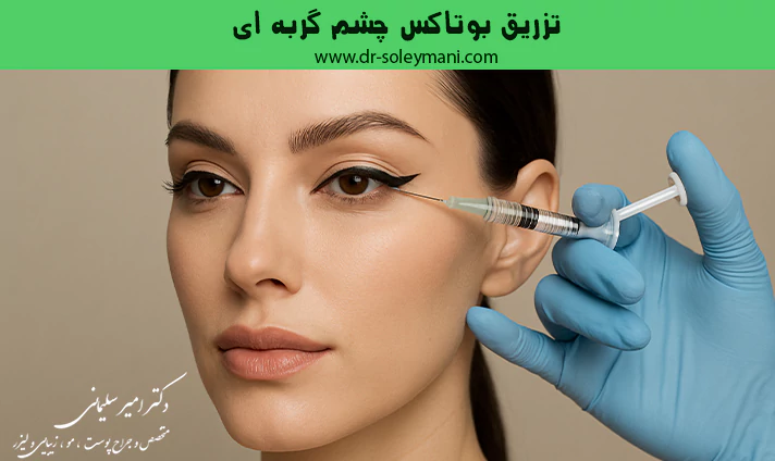 تزریق بوتاکس چشم گربه ای