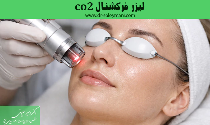 لیزر فرکشنال co2