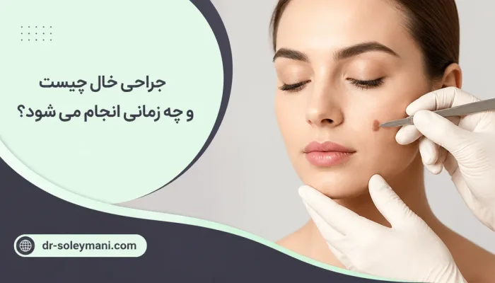 نمای توضیحی درباره جراحی خال صورت چگونه انجام میشود