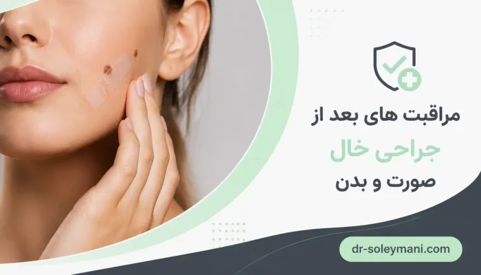 نمای توضیحی درباره جراحی خال صورت چگونه انجام میشود
